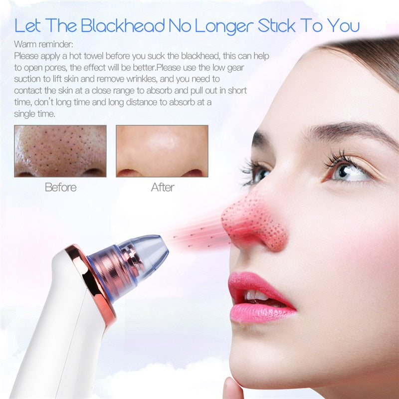 Blackhead Remover Vacuum