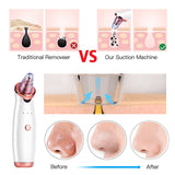 Blackhead Remover Vacuum